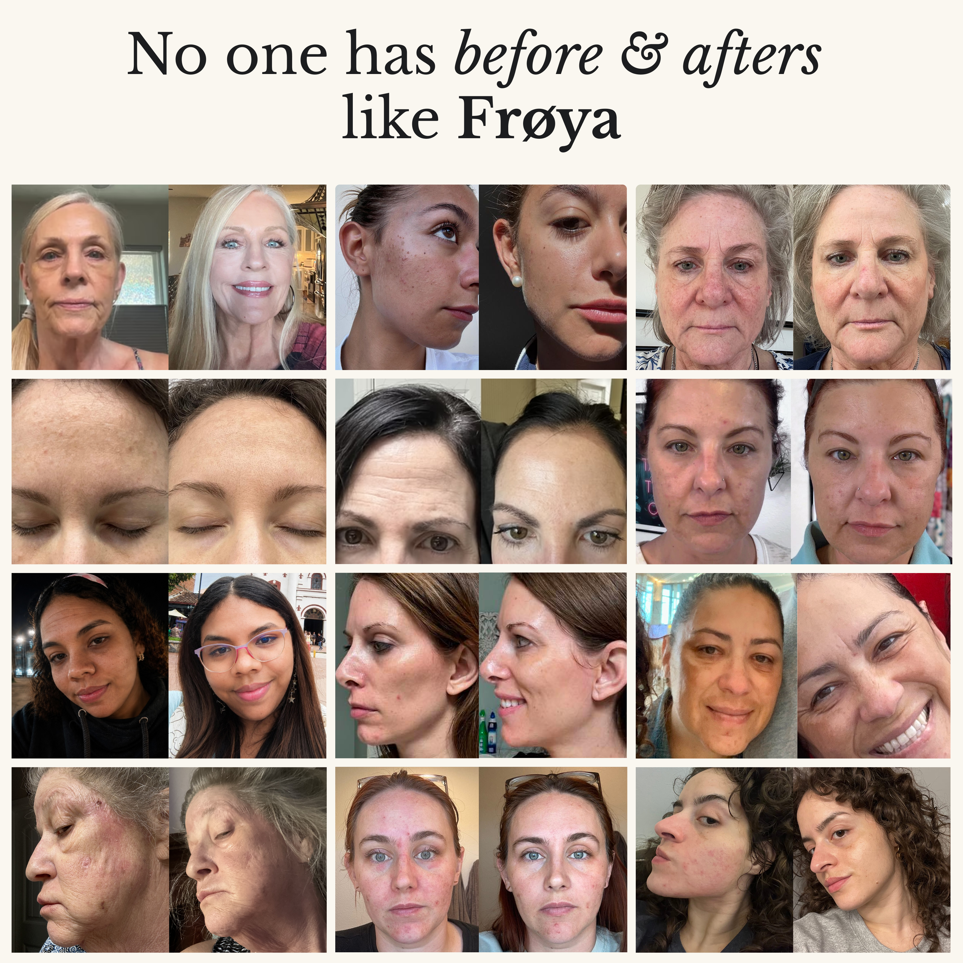 Frøya Organics Complete Mature Skin System — grid of customer before and after results
