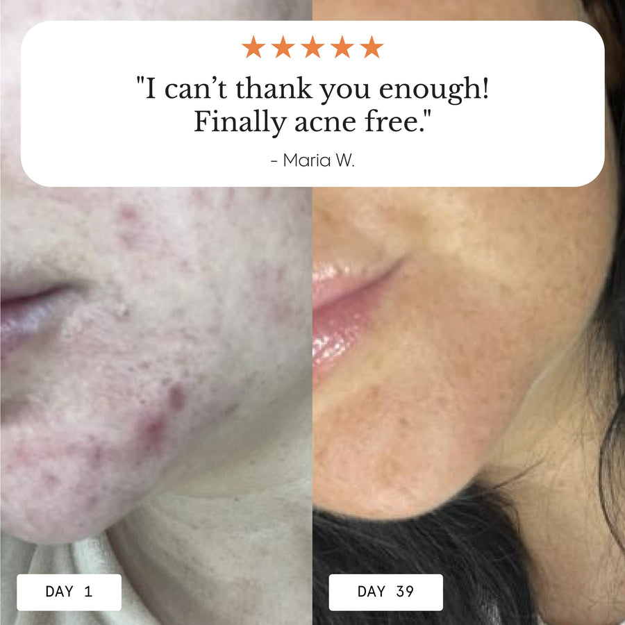 Instant Redness & Clarity Balm