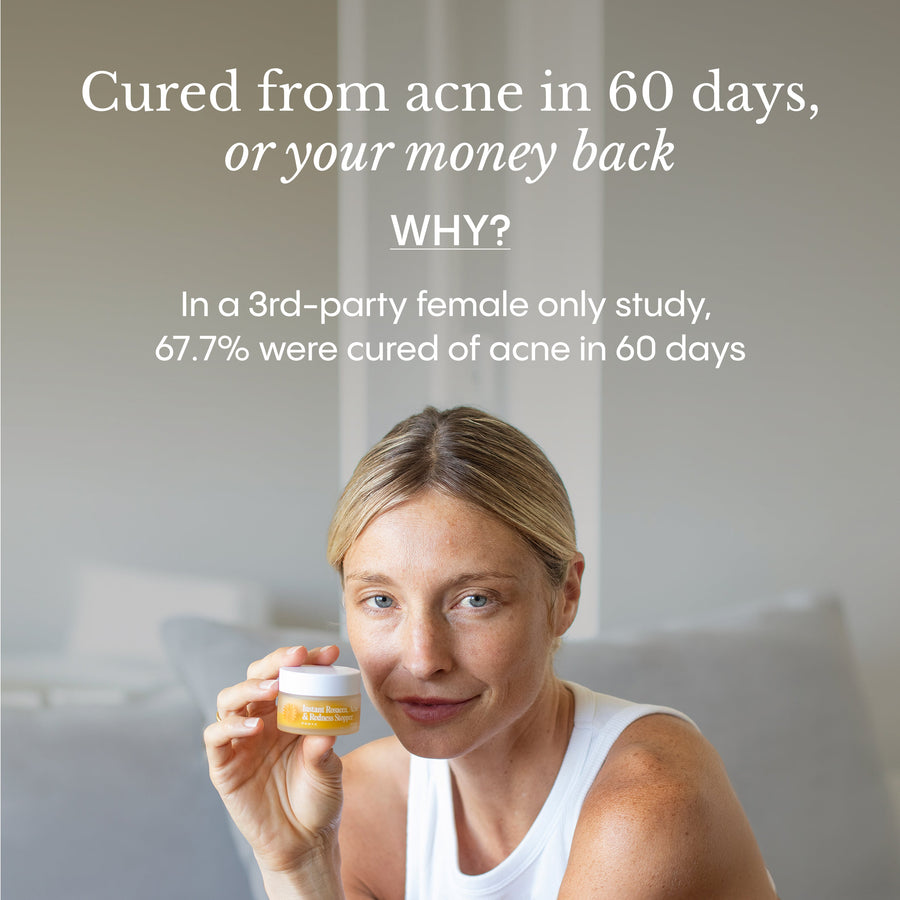 Instant Redness & Clarity Balm
