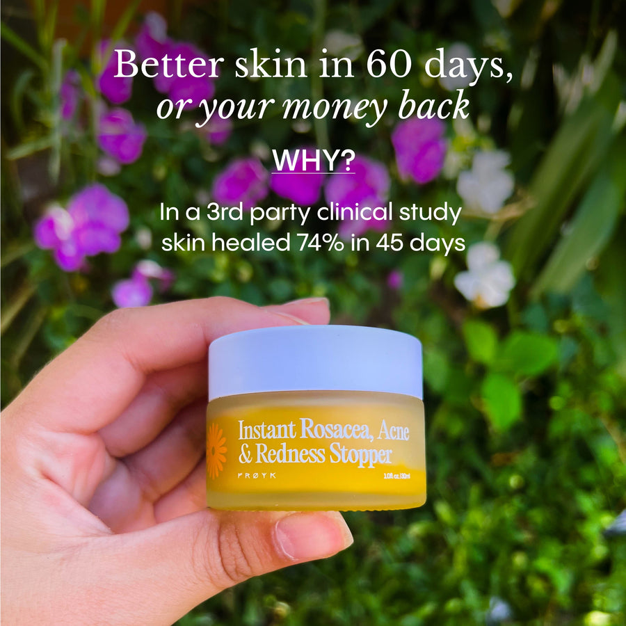 Instant Redness & Clarity Balm