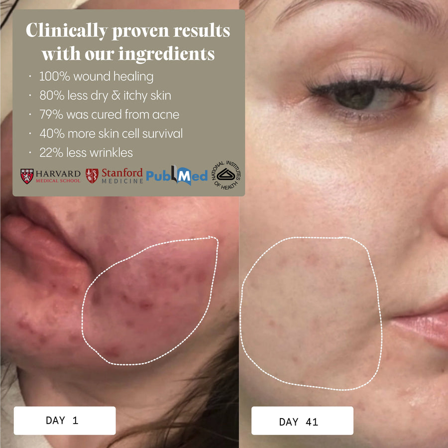 Instant Redness & Clarity Balm