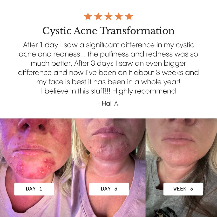 The Complete Clarity System for Women